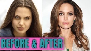 Angelina Jolie: Plastic (Cosmetic) Surgery (2020)