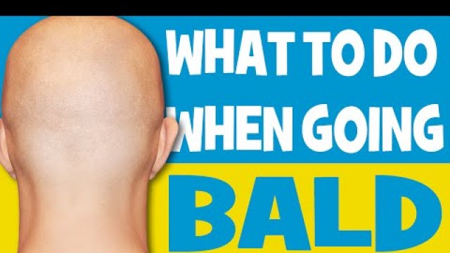 'What to do when going bald ( Men\'s Fashion Advice )'