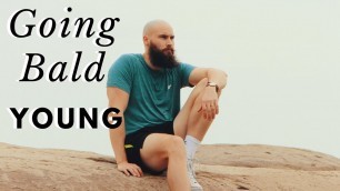 'GOING BALD ADVICE FOR YOUNG GUYS'