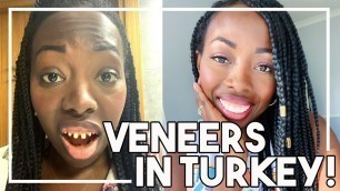 'Getting Veneers in Turkey! THE TRUTH! | Dental Center Turkey!'