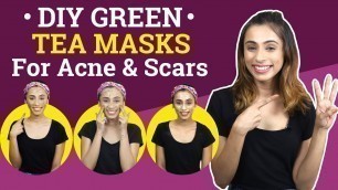 'DIY Green Tea Masks for Acne & Scars | Fashion | Beauty | Pinkvilla'